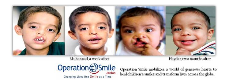 operation smile jordan